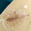 Naraoia spinosa 1